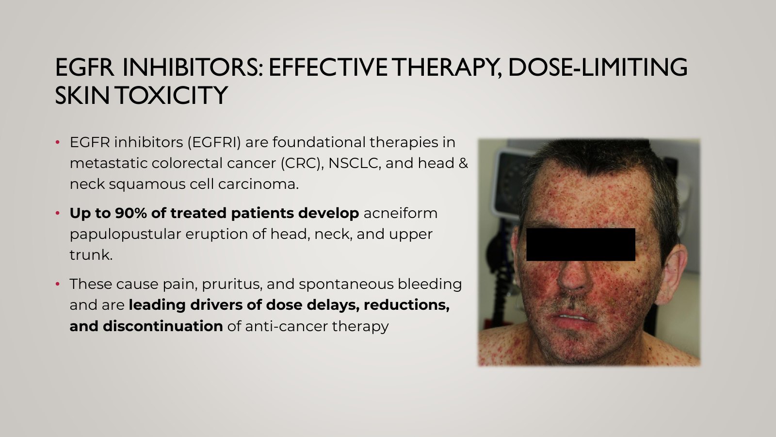 Slide 3, EGFR INHIBITORS: EFFECTIVE THERAPY, DOSE-LIMITING SKIN TOXICITY